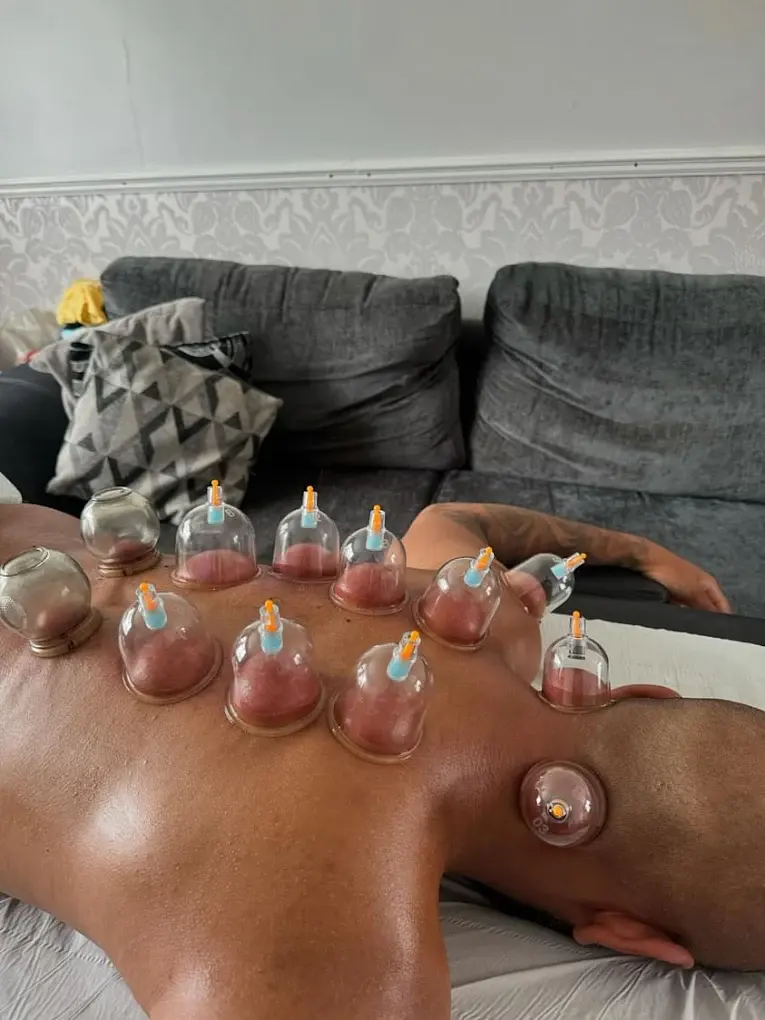 Private mobile therapy setup for hijama and massage at home