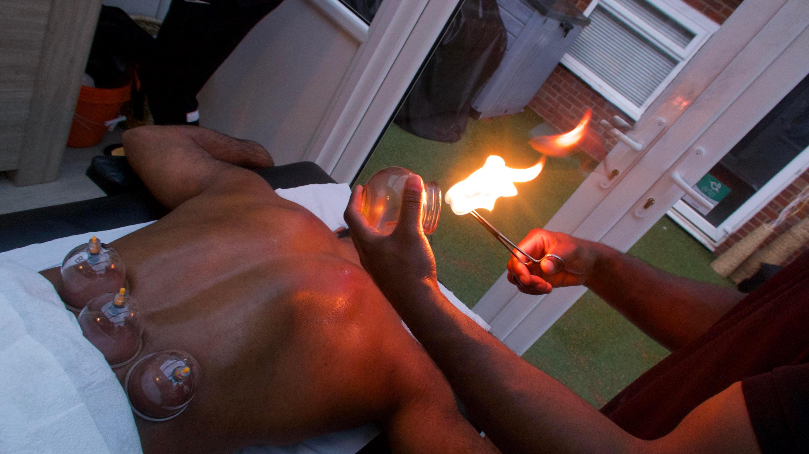 Fire cupping package setup with glass cups