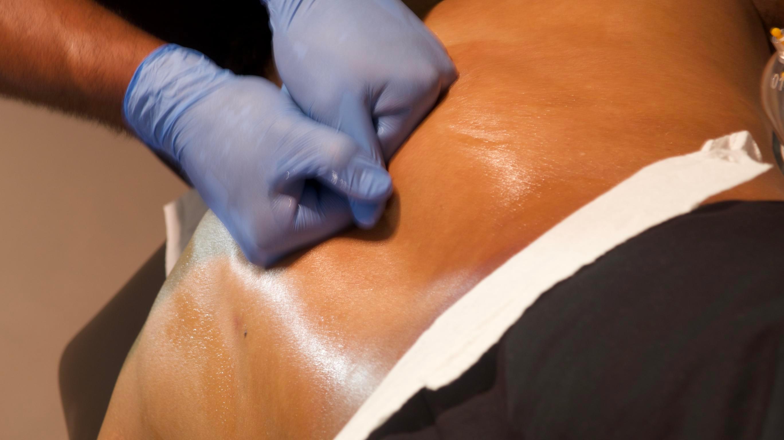 Mobile massage therapy session in Luton