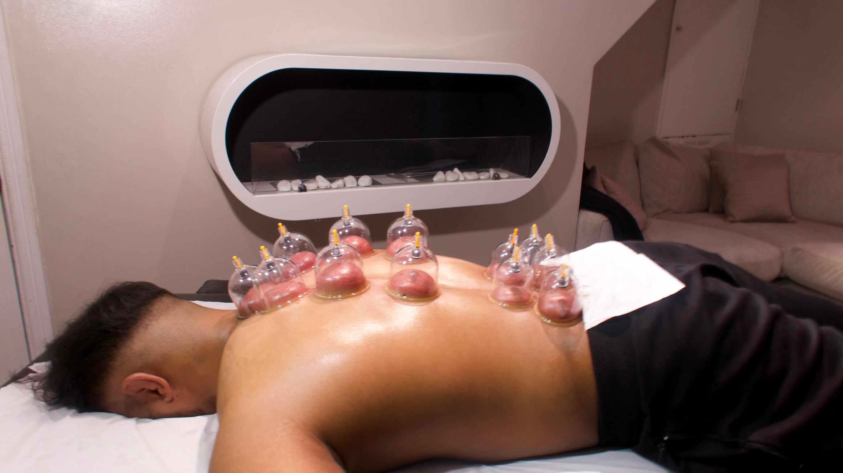 Cupping and IASTM tools used in the Supreme Combo Package